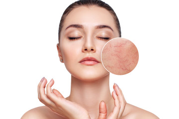 Odstranění cévních lézí